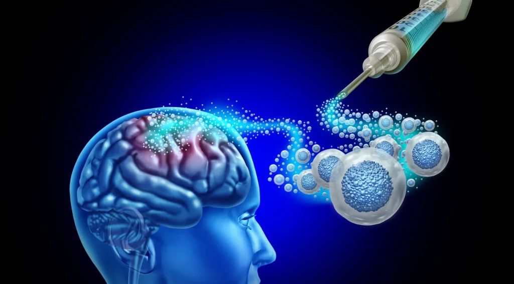 Stem Cell Advances for Parkinson’s Motor Support for Peter Miller